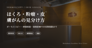 池袋でほくろ・粉瘤・皮膚がんの見分け方｜できもの診察｜池袋サンシャイン通り皮膚科