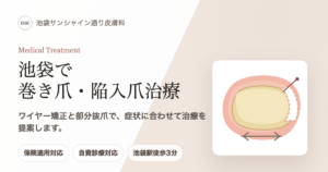 池袋で巻き爪・陥入爪治療｜皮膚外科・部分抜爪（保険適用）｜池袋サンシャイン通り皮膚科