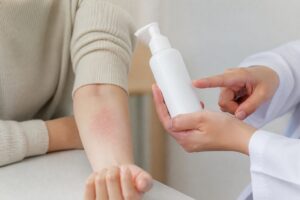 アトピーの市販保湿剤の選び方｜しみるときの確認5項目